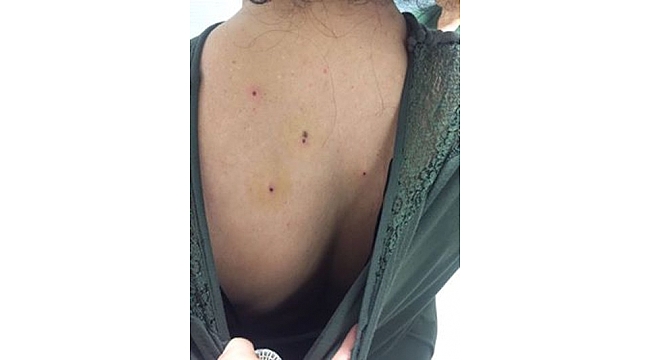 Kına eğlencesinde maganda dehşeti: 10 yaralı