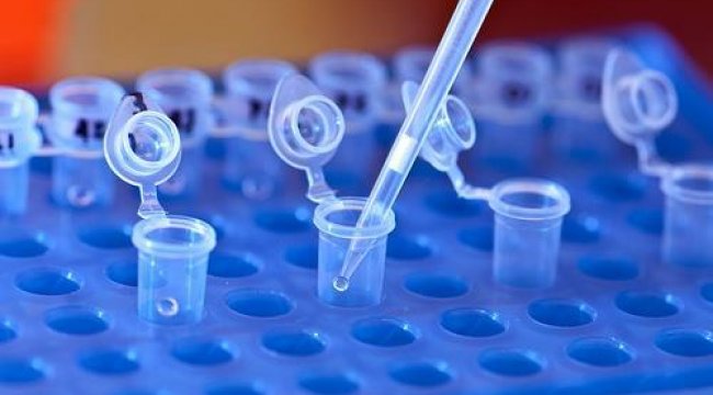 DNA ile ikiz doğumları arasındaki ilişki çözüldü