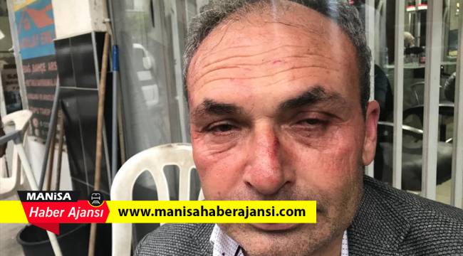 Manisa'da belediye başkan yardımcısına darp