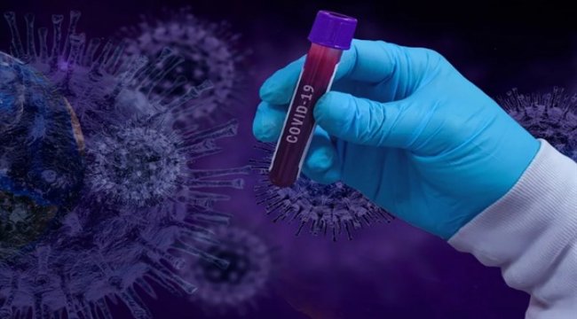 Azərbaycan Respublikasında 325 yeni koronavirus infeksiyasına yoluxma faktı qeydə alınıb
