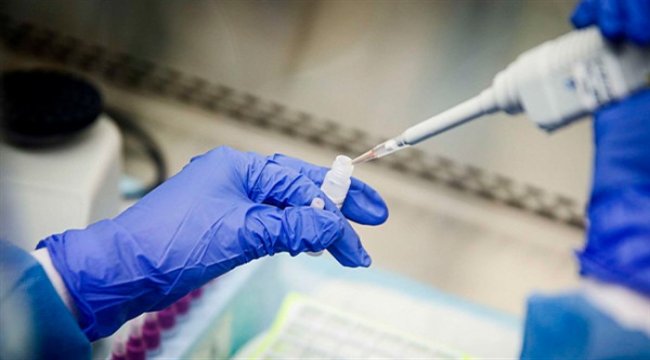 Toshiba и Hitachi присоединятся к производству экспресс-тестов на коронавирус