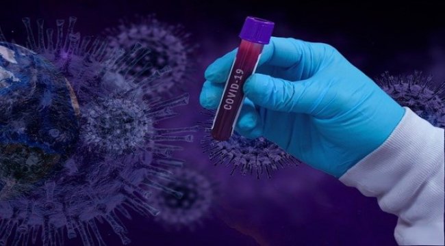 RTA Laboratuvarları, DMO ile kit temini anlaşması imzaladı