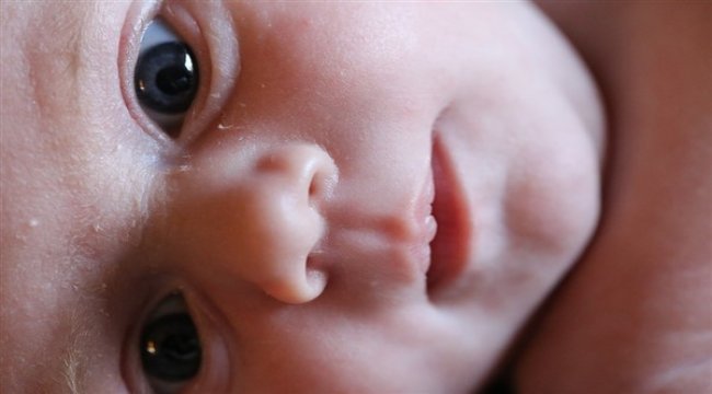 Bioderma’nın katkılarıyla atopik dermatite dikkat çeken online söyleşi