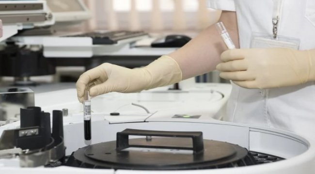 Kimya sektörü ekim ayı ihracatı 1,7 milyar dolar oldu