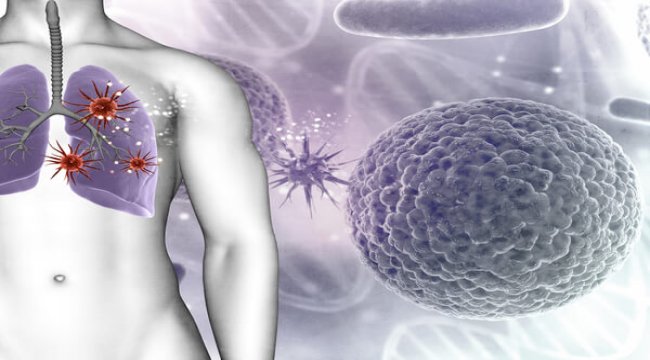Non-Small Cell Lung Cancer Clinical Trials