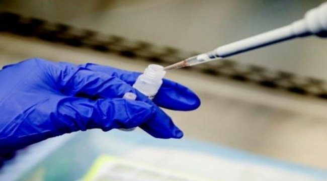 RTA Laboratuvarları, Malatya'da yeni tesis kuracak