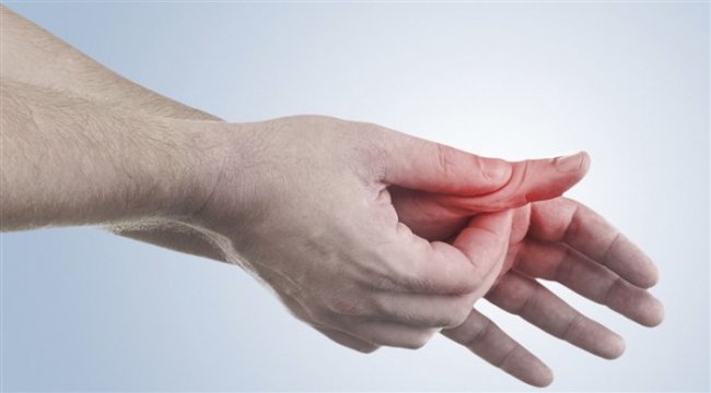 Sedef hastalığı sadece cildi etkilemiyor