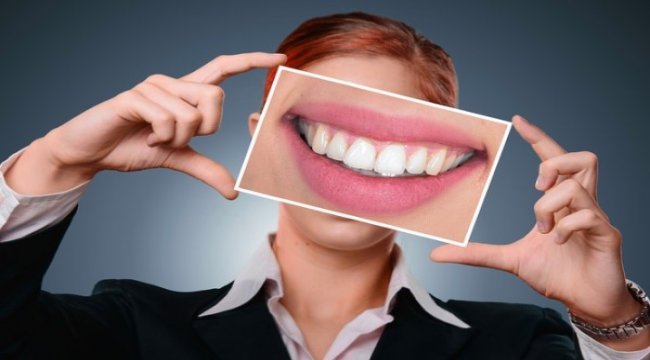 Yeni nesil diş kaplamaları estetik kaygıları sona erdiriyor