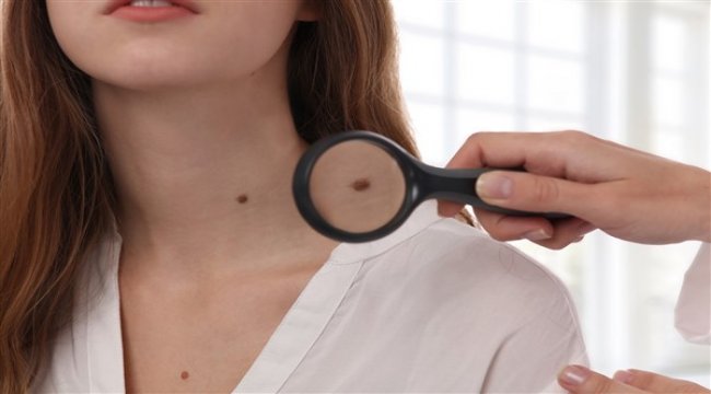 Yeni oluşan benlere ve iyileşmeyen yaralara dikkat