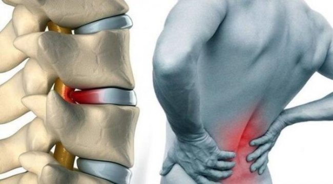 Belinizi sağlıklı ve güçlü tutmak için 7 maddeye dikkat