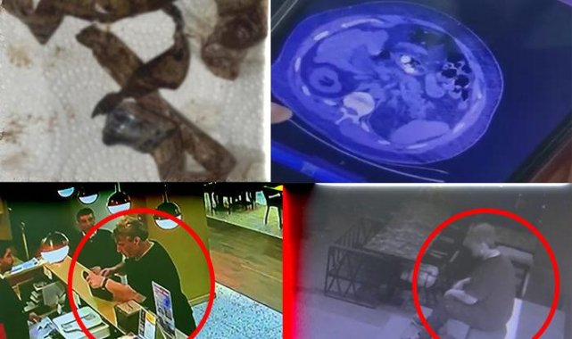 Midesinde patladı, hayatına mâl oldu!