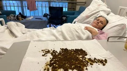 Soma’da 70 Yaşındaki Hastanın Safra Kesesinden 20 Bin Taş Çıktı