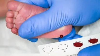 Topuk Kanı Tartışması: Aile ve Hastane Karşı Karşıya